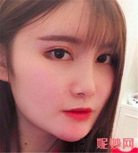 北京八大處的張智勇醫生做正頜（hé）手（shǒu）術怎（zěn）麽樣？真人案例分享