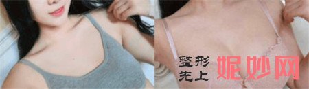 穆大（dà）力隆胸怎麽樣？