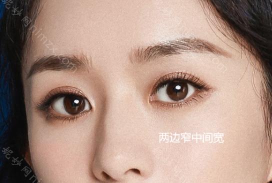 合肥藝星孫洋修複雙眼（yǎn）皮值得信賴嗎?技術好，收費合理，值得信賴