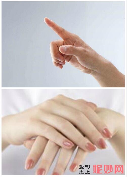 北京上上相整形（xíng）醫院擅長全臉脂肪填充失（shī）敗修複嗎?鄭楚蓉吸脂填充技術（shù）怎麽樣_豐手案例